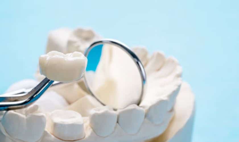 Caring for Your Brookhaven, GA, Dental Crowns: Do’s, Don’ts, and Maintenance Tips