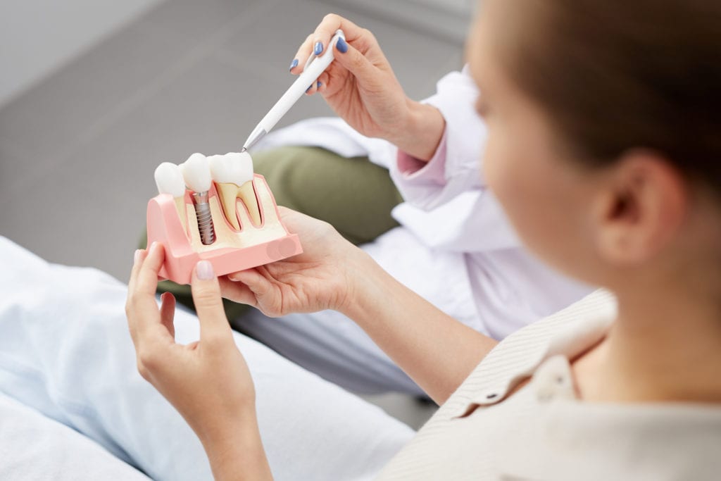 Post-Dental Implant Care: What You Need to Know?