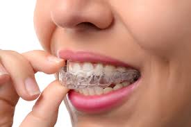 Benefits of Invisalign Clear Aligners for Adults and Teens in Duncanville, TX